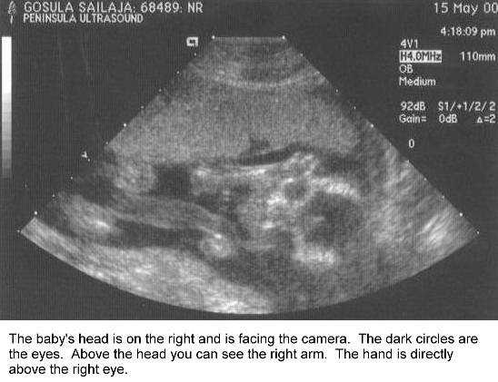 B18weeks.jpg